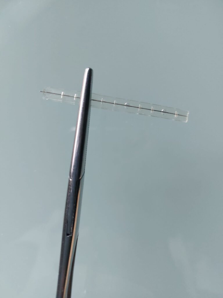 orthonyxie